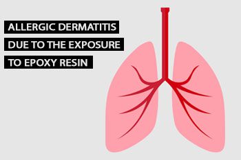 Respiratory Irritation